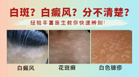 胳膊上出现小圆浅色白斑是什么