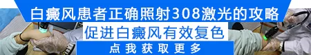 308激光治疗白斑一次的费用