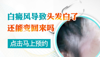 做黑色素移植手术后白眉毛还可以变黑吗