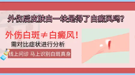 磕伤引起的白斑会是白癜风吗