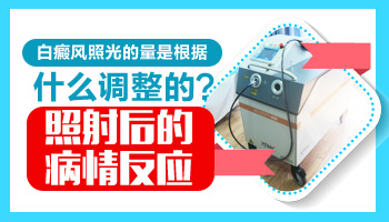 美国308激光治疗眼周白癜风剂量是多少