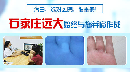 白癜风在治疗中怎么还会长白斑