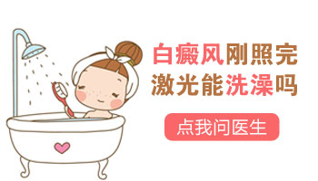 白癜风照完308激光能立即洗澡吗