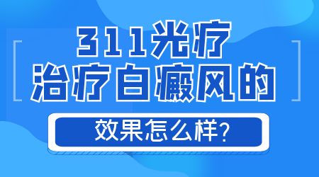 白癜风照uvb白斑更多了怎么回事