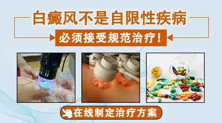 白癜风有没有自我恢复的有效方法