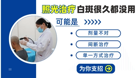 白癜风光疗几个月白斑没变化该放弃吗