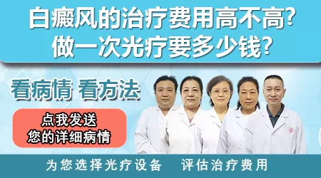 白癜风做光疗大概要多少钱