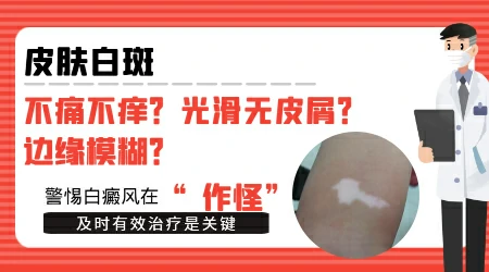 身上长不痛不痒的小白斑需要马上检查吗