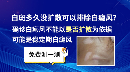 十几年都没扩散白癜风还会扩散吗