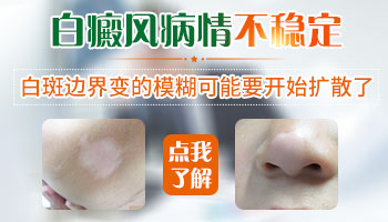 白斑周围变得模糊了代表什么