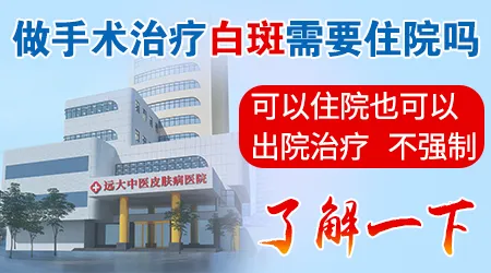 腿上白癜风种植需要住院吗