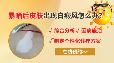军训暴晒后脸上长白点是怎么回事