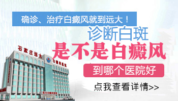 大面积皮肤变浅是不是白癜风的征兆