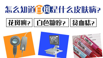 背上长白点2个月了没什么感觉会是什么病