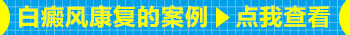 男孩乳晕白癜风可以用308光疗仪吗