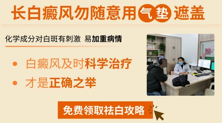 白斑长在脸上怎么快速遮盖无副作用