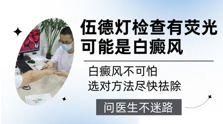 伍德灯下白斑部分有荧光部分没有是怎么回事