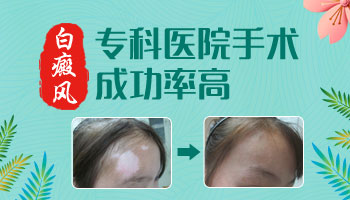 白癜风取皮的地方长出白癜风怎么回事