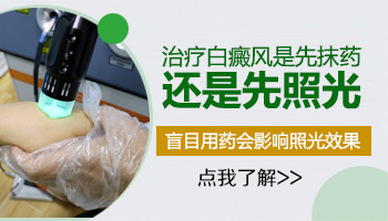 白癜风照光多长时间能抹药