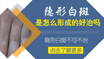 伍德灯下浅白色白斑边界模糊不清是新发的白斑吗