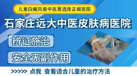 石家庄儿童白癜风去哪里看比较好