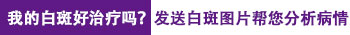 伍德灯检查白斑蓝白色是什么情况