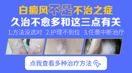 为什么一直吃药白癜风还会发展