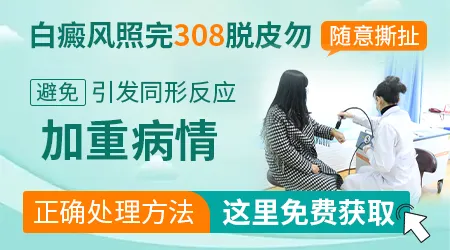 白癜风光疗后皮肤干燥脱皮该怎么处理
