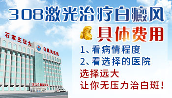激光治疗白癜风的费用是多少