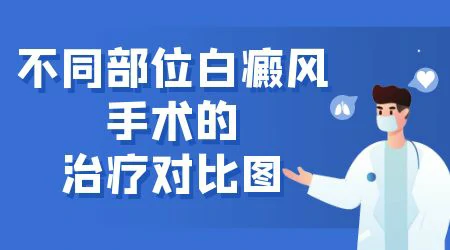 儿童白癜风植皮手术适合多大孩子做