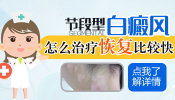 小孩节段型白癜风好治吗