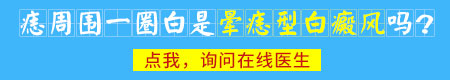 黑痣周围一圈白色的环是怎么回事