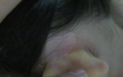 男生耳朵旁边白一块是得了什么病
