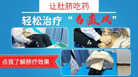 311紫外线照白癜风效果对比图