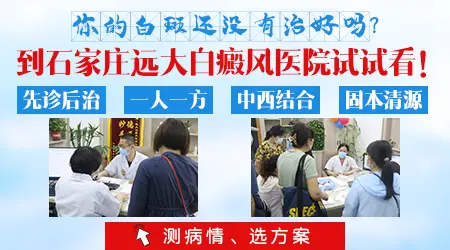 中药能治好白癜风吗 治好白斑案例