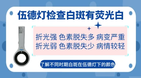 伍德灯照白癜风出现瓷白色是什么情况