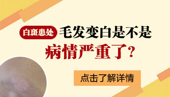 脸上长白斑汗毛变白