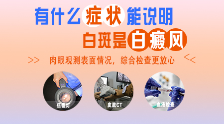 白斑一周了是什么病