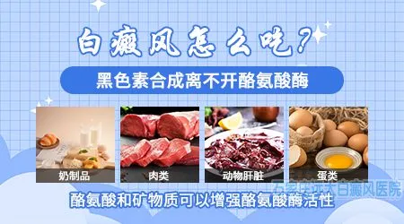 十种开心食物治疗白癜风忧郁