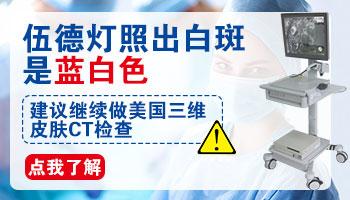 伍德灯下皮损处呈淡蓝白色荧光