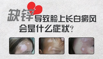 小孩缺锌脸上长白斑图片