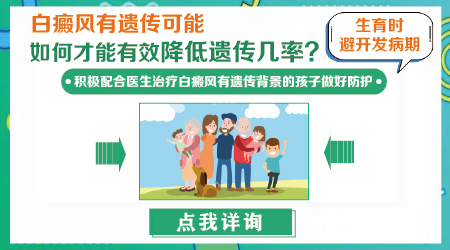 白癜风会遗传给儿子还是女儿
