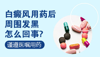 白癜风用药过敏肿了吃什么好