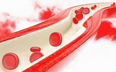 早期白斑图片大全 白斑诊断多少钱