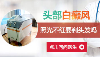 激光治疗毛囊性白癜风头发需要剃光吗