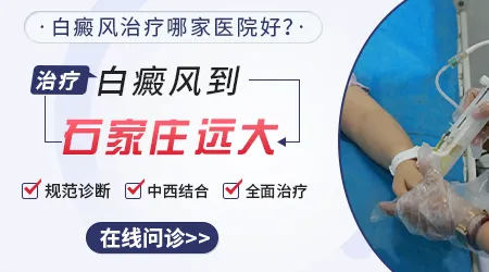 石家庄哪家医院能治大面积白癜风