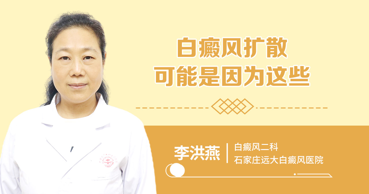 白癜风扩散可能是因为这些
