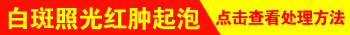 白癜风照光起泡起皮是怎么回事