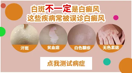 儿童白斑和白癜风有什么区别