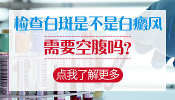 做白癜风检查早上能吃饭吗